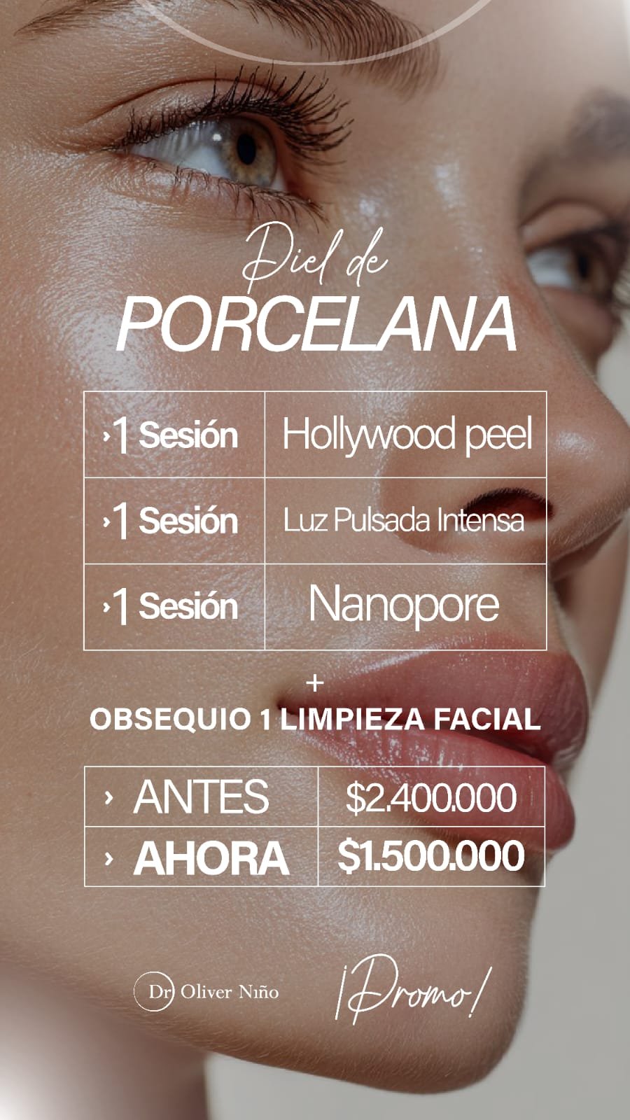 Piel de Porcelana - Hollywood peel + Luz Pulsada + Nanopore